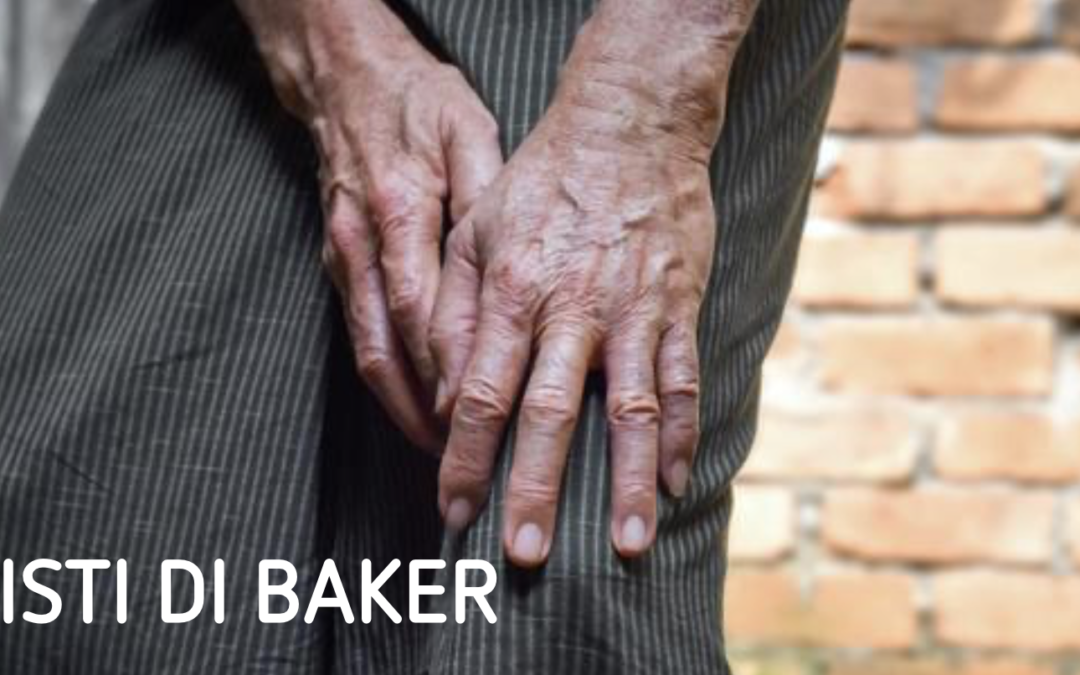 Fisioterapia Cisti di Baker: Un Approccio Conservativo Prima dell’Intervento Chirurgico